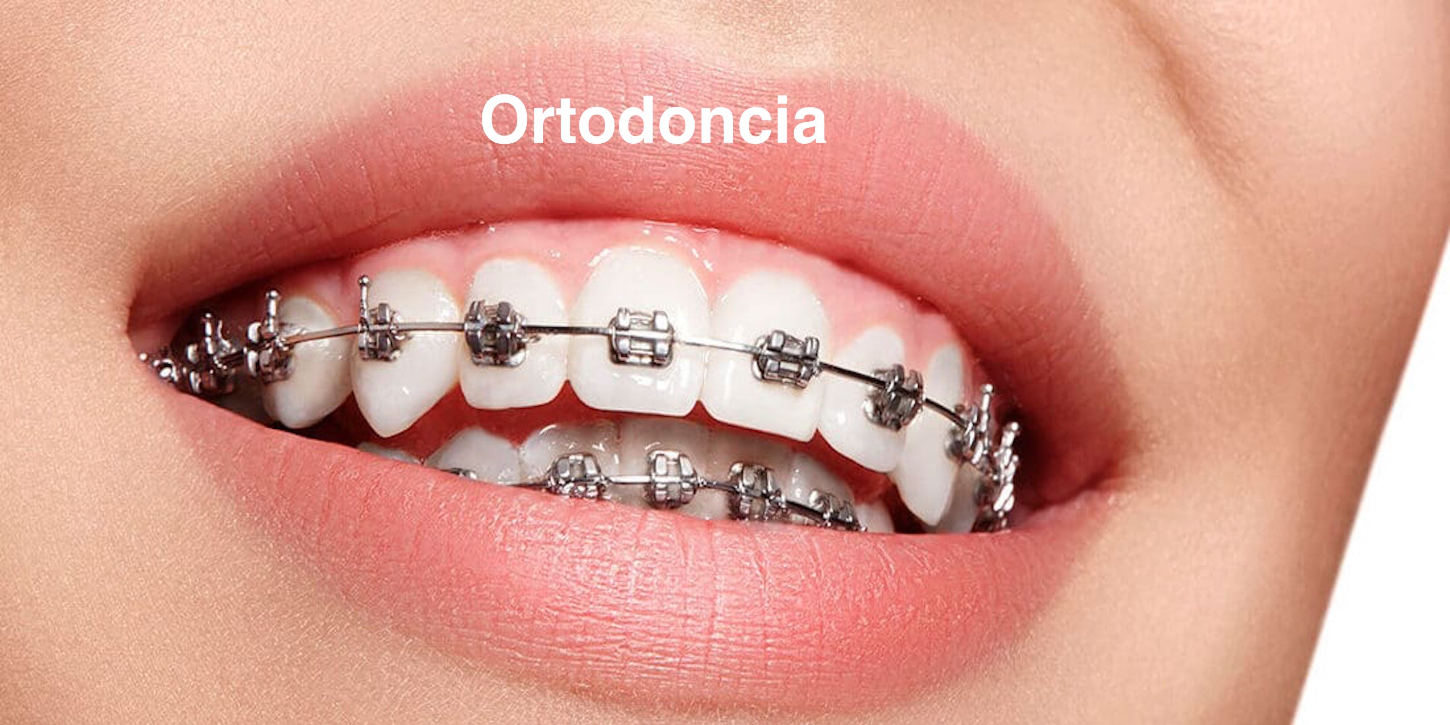 Ortodoncia<br>¡Consulta por tu hora aquí!